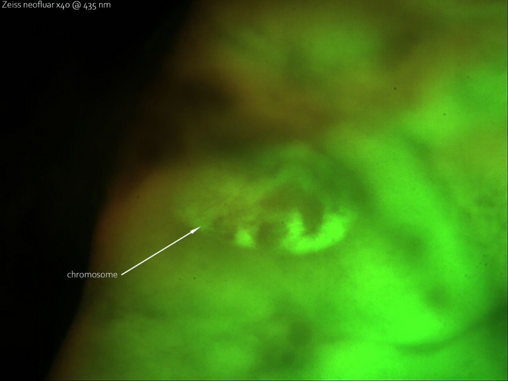 10 juin 21 chironomes chromosomes essai 2 epi.jpg