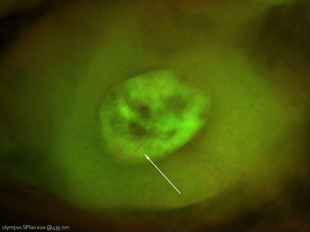 10 juin 21 chironomes chromosomes essai 3 epi.jpg