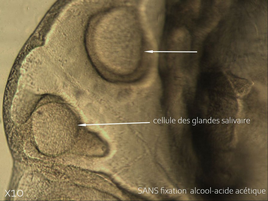 11 juin 21  glande salivaire SANS fixation.jpg