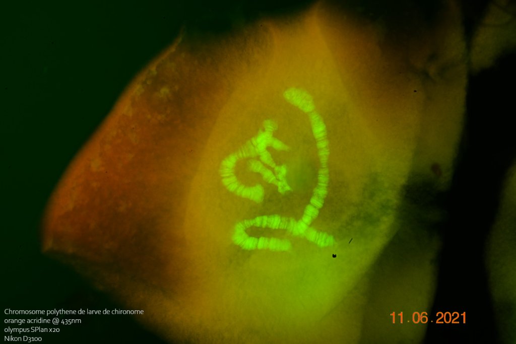 11 juin 21 chromosome chironome epifluo ++++.jpg