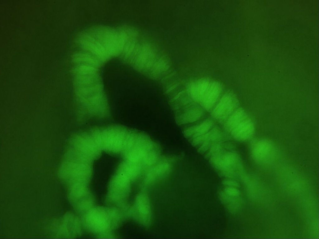 11 juin 21 chromosome chironome x40  bis.jpg