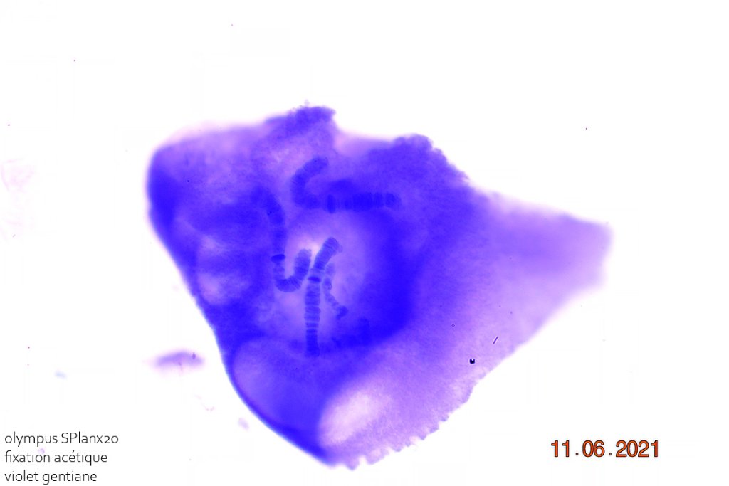 21 juin 21  chromosome chironome fixation acétique violet x20 3.jpg