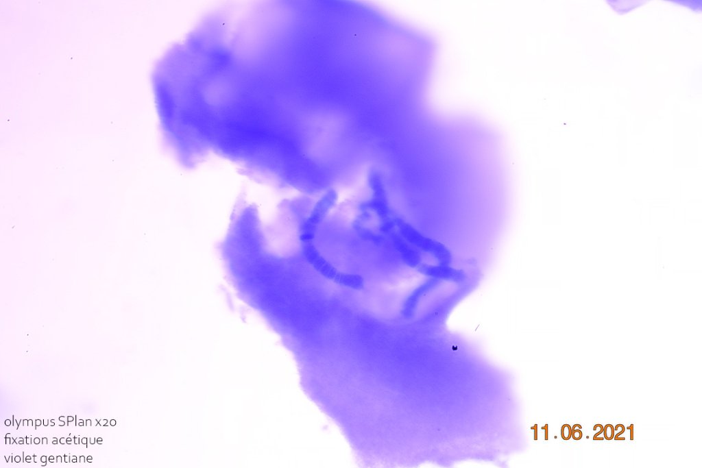 21 juin 21  chromosome chironome fixation acétique violet x20 2.jpg