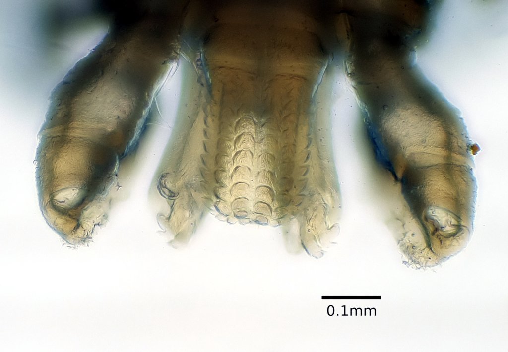 D.variabilis_hypostome_100x.jpg