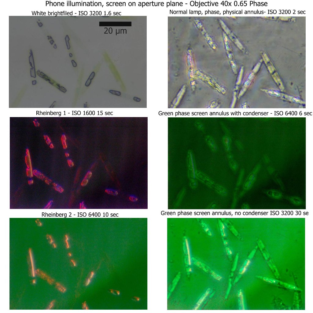 Comparison Diatoms with Phase and Rheinberg phone screen illumination