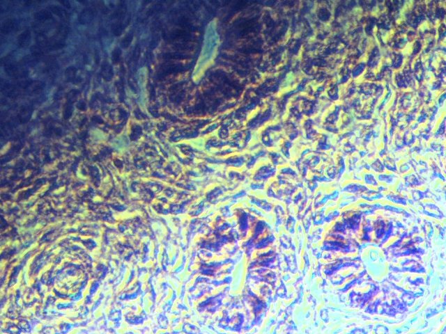 UTERUS SEC 40X PHC OBLIQUE.jpg