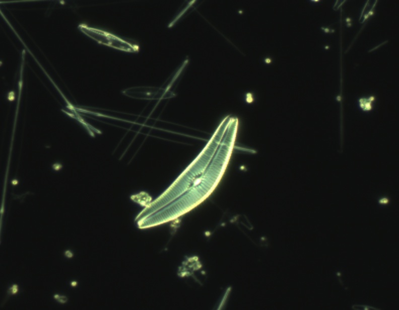 Diatom-Strew-df.jpg