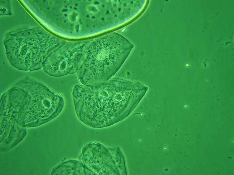 epithelial-green-filter.jpg