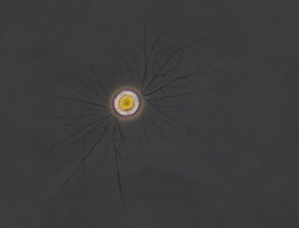 Amoeba phase contrast