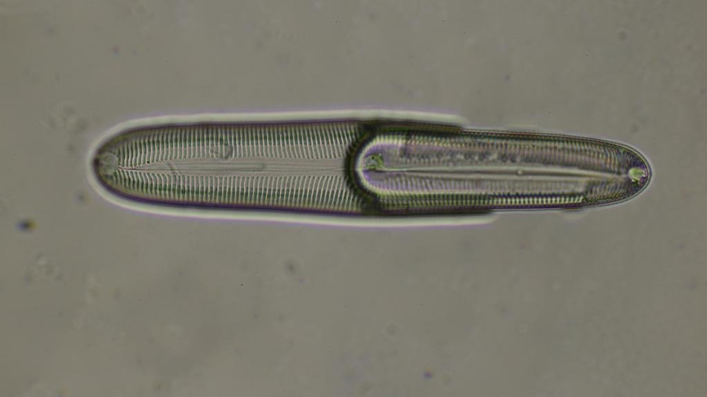 Pinnularia 205um, half-sunk in nail polish gel, BF 40X0.75, color tweaked.JPG