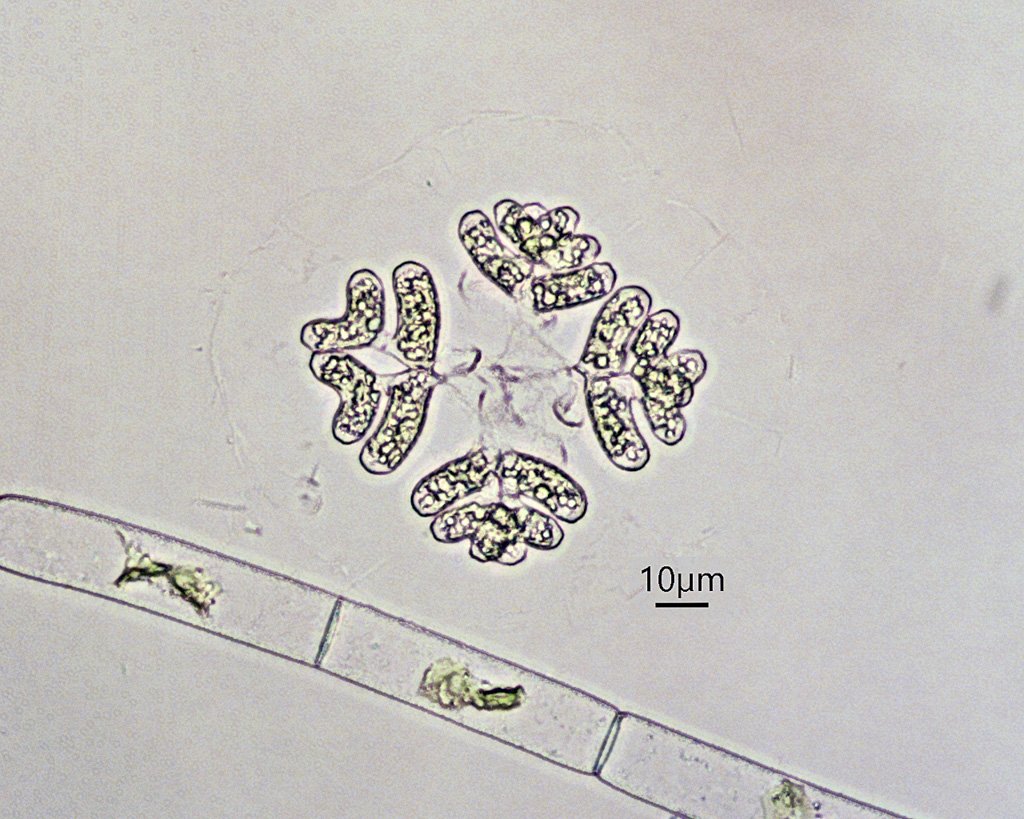 Dimorphococcus - stacked image