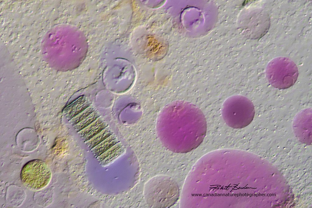 Cytoplasm 630X DIC