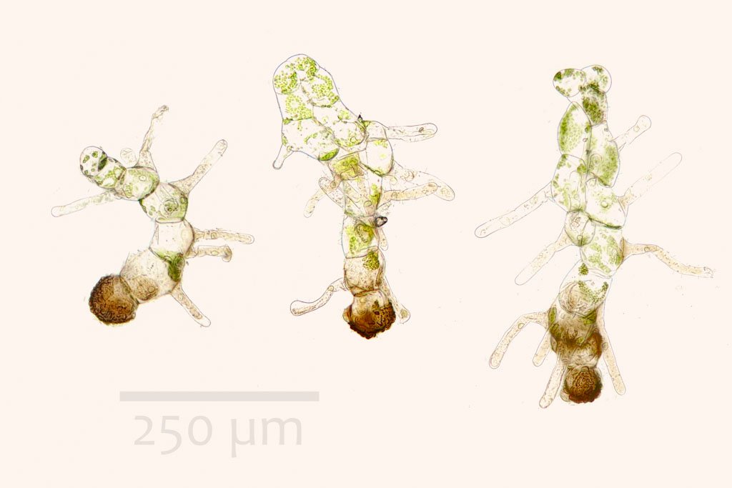 Dryopteris wallichiana later development stage 20x