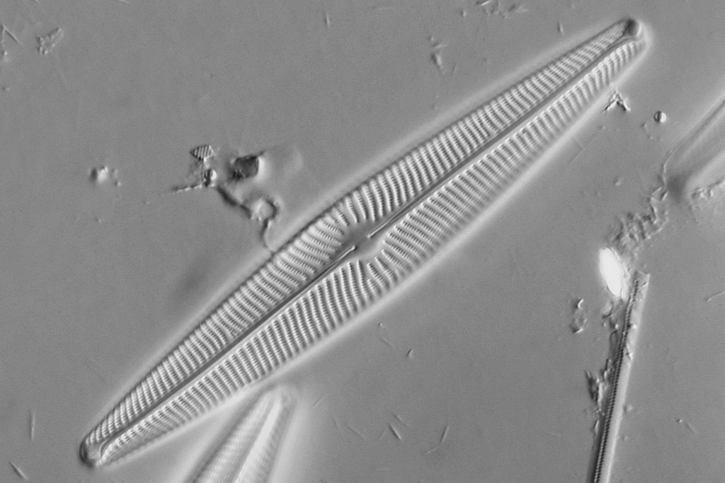 Diatom: Navicula sp.???