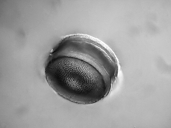 Centric Diatom 45µm.jpg