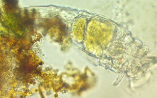 ROTIFER 40X.jpg