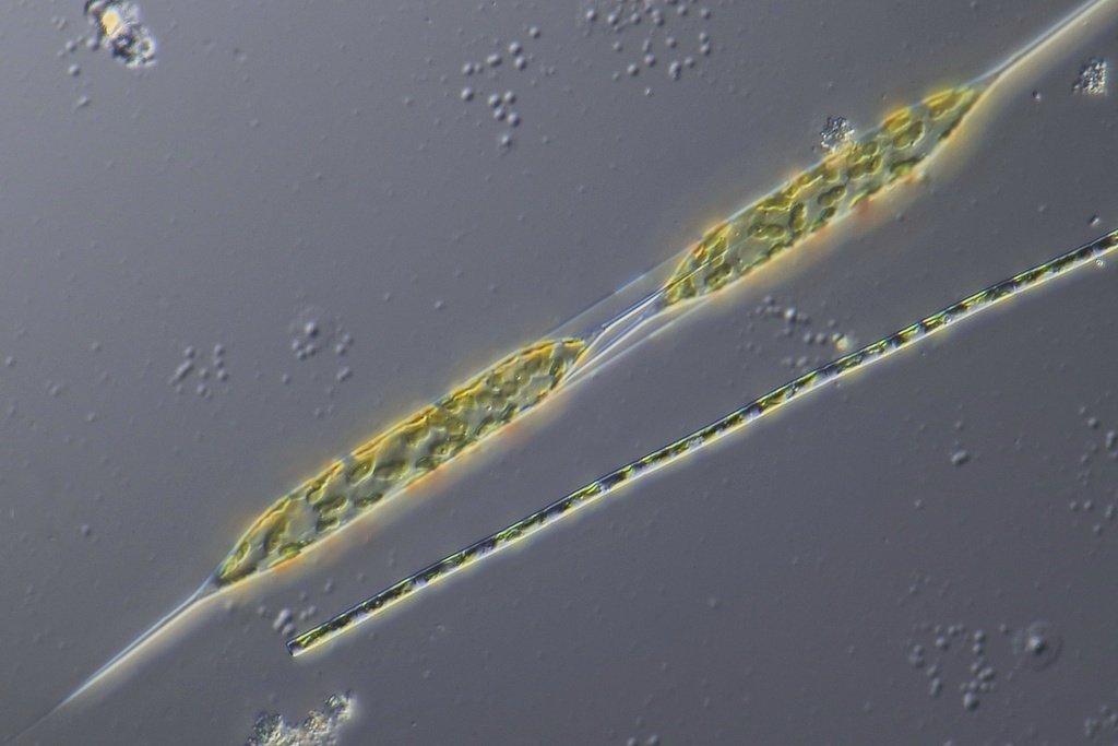 1-13-22 Rhizsolenia sp 20x.jpg