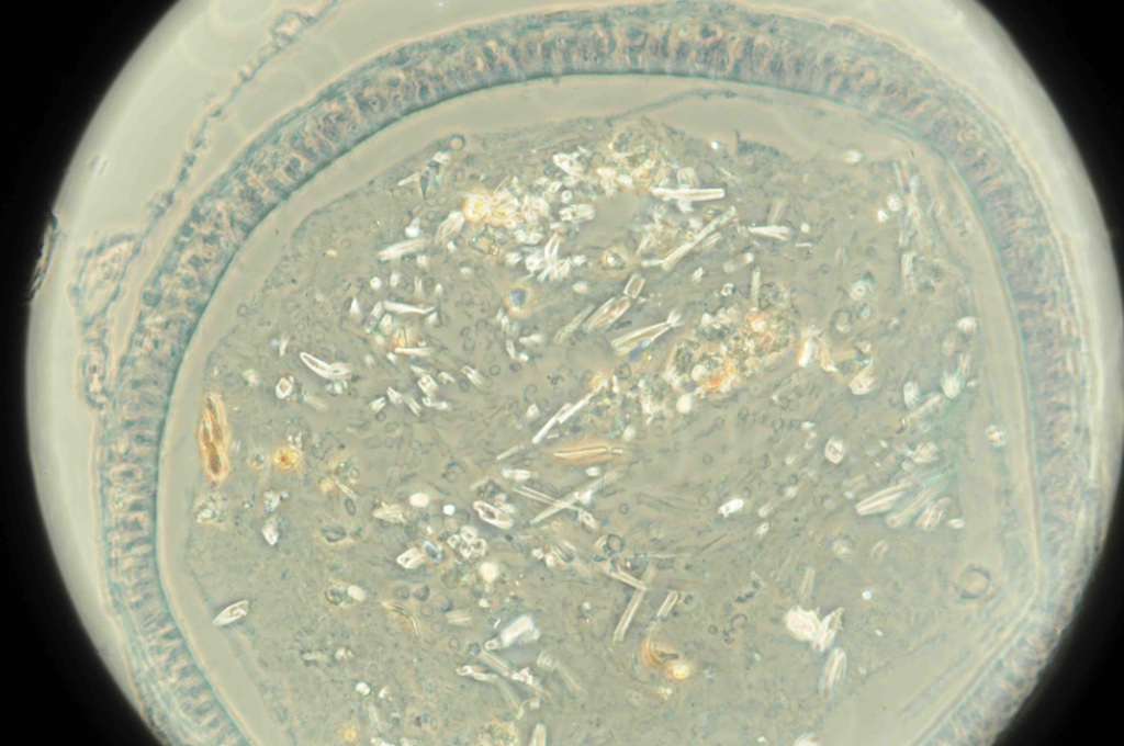 tadpole intestine  small.jpg