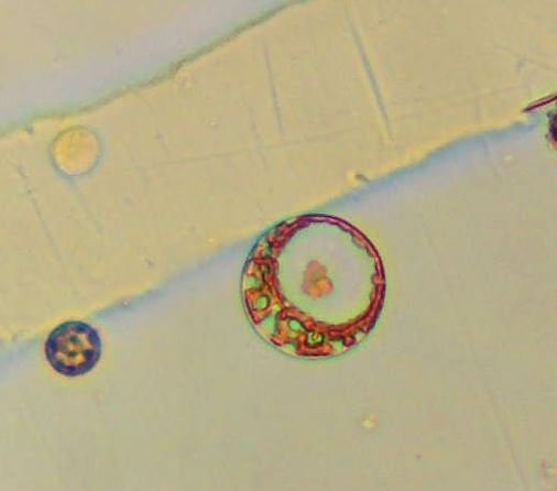 close up ring plankton.JPG