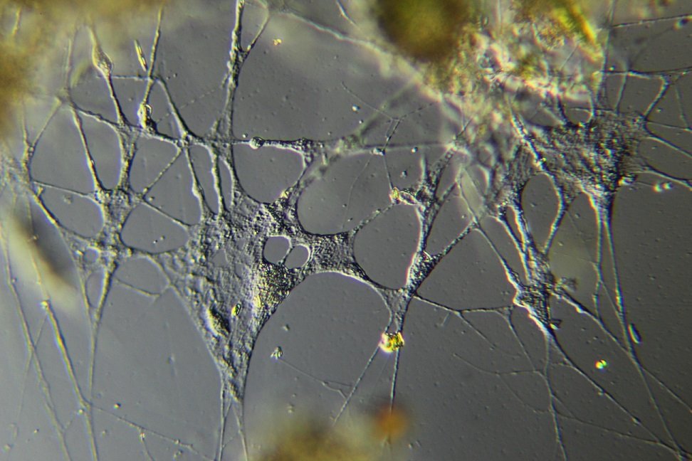 Reticulomyxa-2.jpg