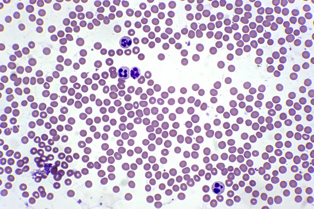 BLOOD_SMEAR.jpg