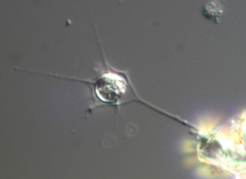 Hedriocystis-2.jpg