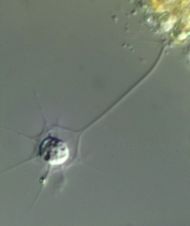 Hedriocystis-1.jpg