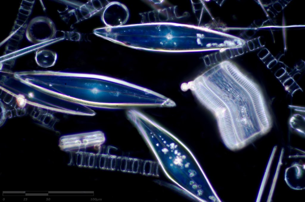 Pleurosigma gang....but looks like a standoff. The right side 'diatom' could be a &quot;ribbon&quot; of many individual diatoms. That's my guess.
