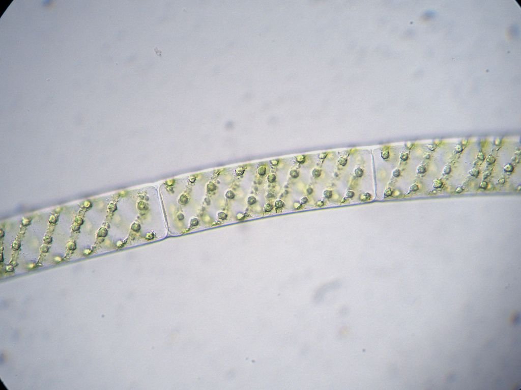 Spirogyra.jpg