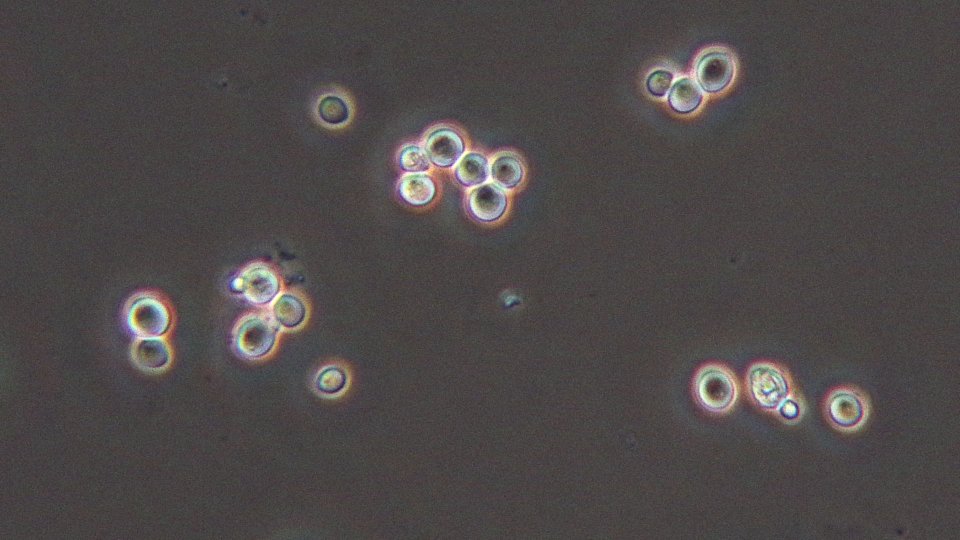 40x phase contrast objective with phase ring in condenser