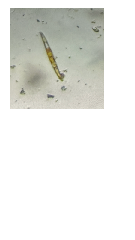 gold diatom 1.png