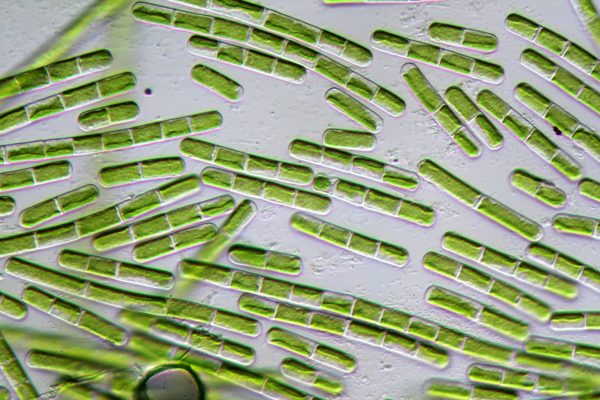 Unidentified algae from a water sample in oblique illumination