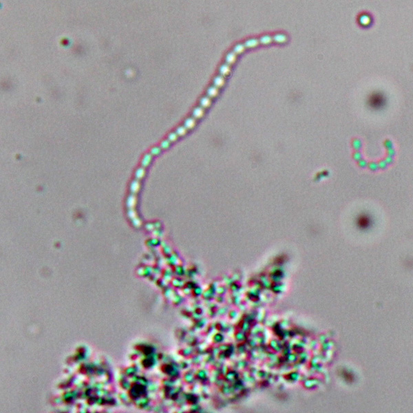 Observing Bacteria Under The Light Microscope Microbehunter Microscopy