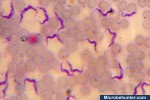 Trypanosoma brucei gambiense